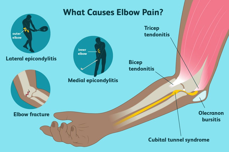 đau khuỷu tay khi đánh cầu lông