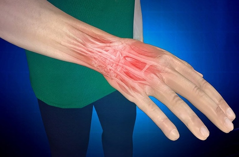 Những chấn thương nguy hiểm nếu không sử dụng băng cổ tay